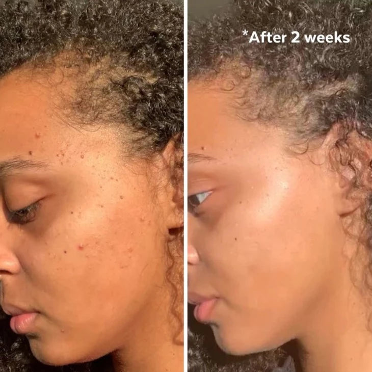 Three Ships Superfruit Lactic + Multifruit AHA MASK before & After